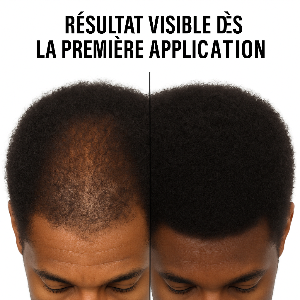 Crème Capillaire - couvre la calvitie, les cheveux blancs et les trous de barbe