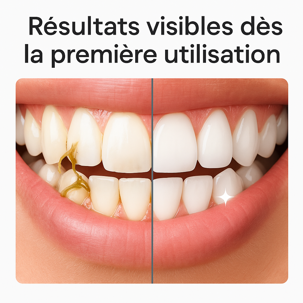 Irrigateur Dentaire - Nettoyez vos dents comme chez le dentiste