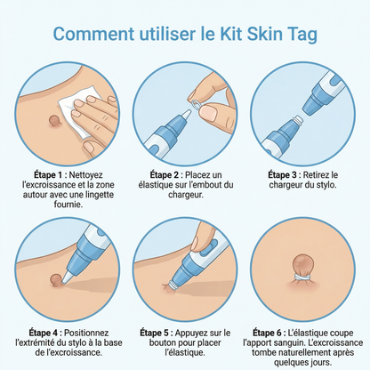 Kit Skin Tag – Éliminez les excroissances de peau à la maison
