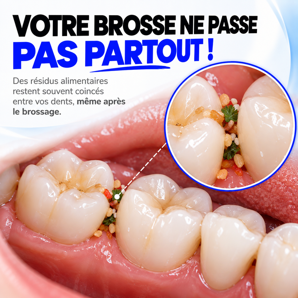 Irrigateur Dentaire - Nettoyez vos dents comme chez le dentiste