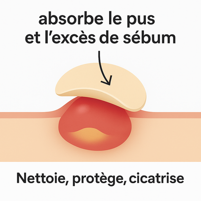 Patch Anti-Acné Invisible - Dites adieu à vos boutons