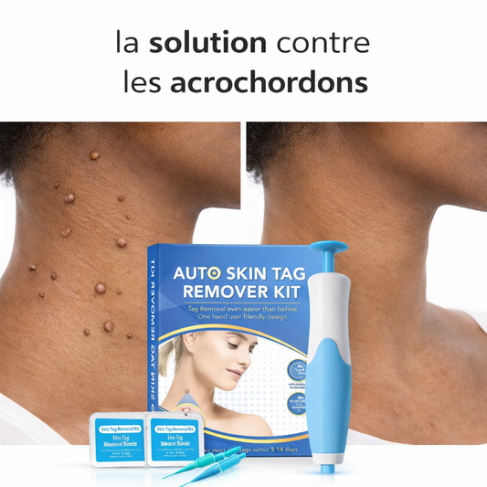Kit Skin Tag – Éliminez les excroissances de peau à la maison