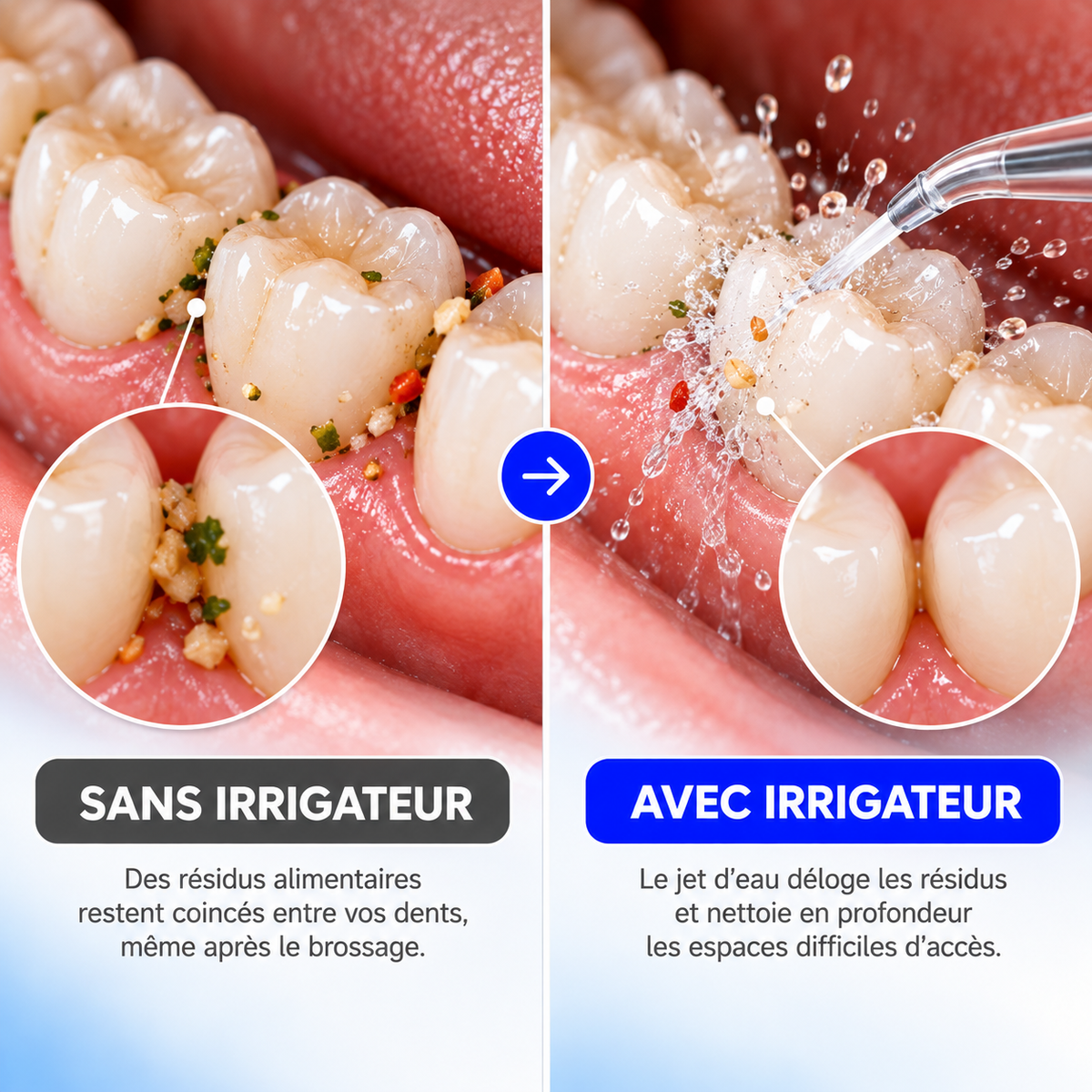 Irrigateur Dentaire - Nettoyez vos dents comme chez le dentiste