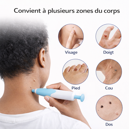 Kit Skin Tag – Éliminez les excroissances de peau à la maison