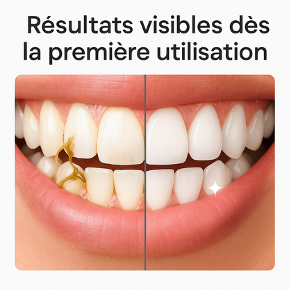 Irrigateur Dentaire - Nettoyez vos dents comme chez le dentiste