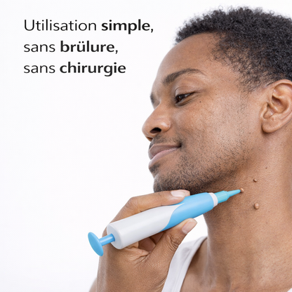 Kit Skin Tag – Éliminez les excroissances de peau à la maison